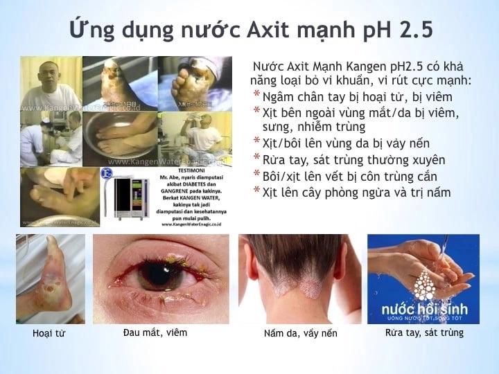 Máy lọc nước điện giải kangen k8 - 9